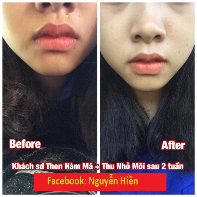 Tinh chất thon hàm má, thu xương quai hàm, hạ gò má cao | BigBuy360 - bigbuy360.vn