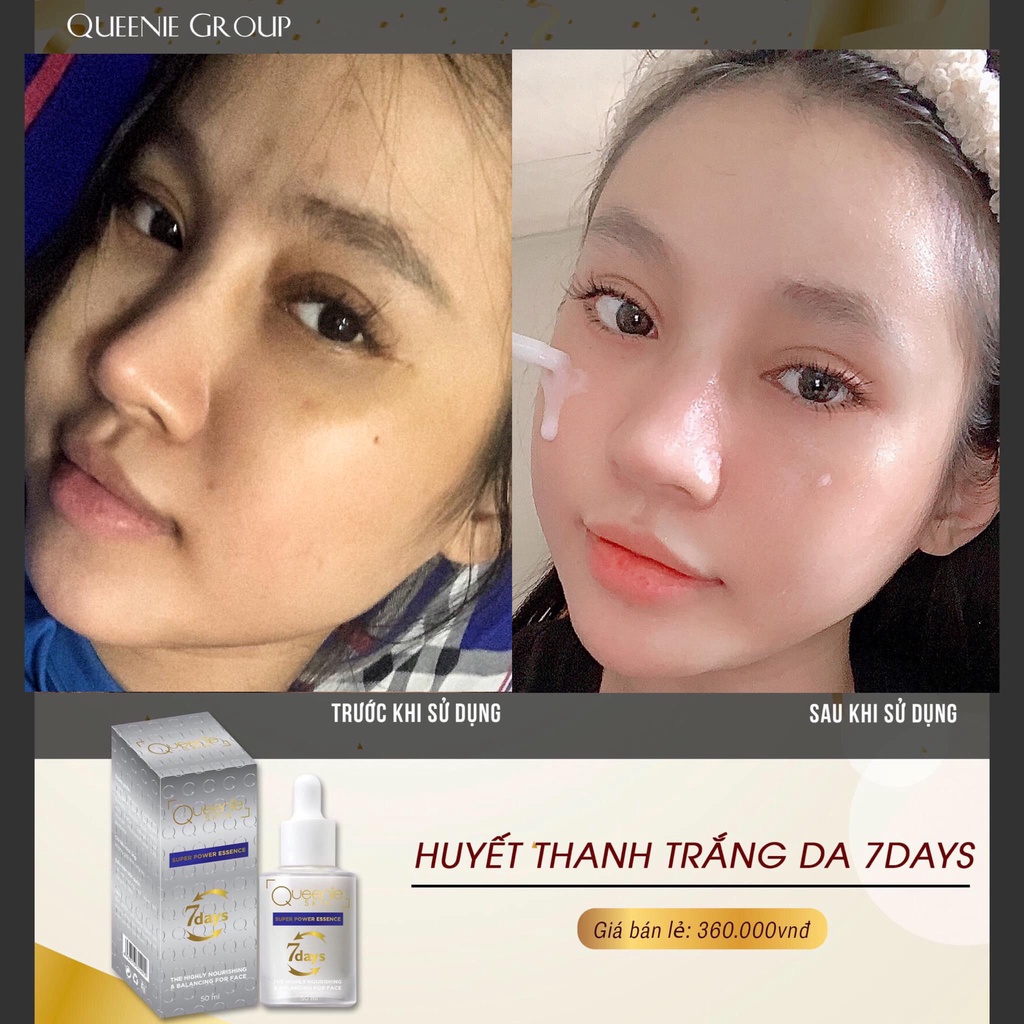 [FreeShip + Tặng Quà] Huyết Thanh 7Day Queenie Skin - Serum Huyết Thanh 7Day Queenie Skin Date 2024