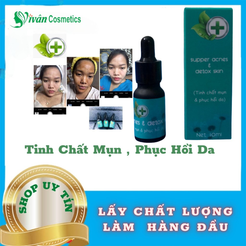 Tinh Chất Mụn Serum LIGI Dung Tích 10ml