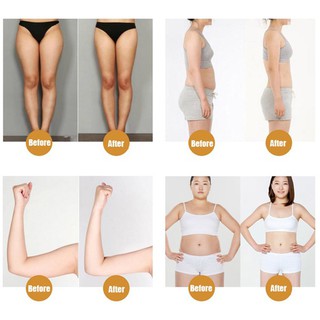 10 Miếng Dán Giảm Cân