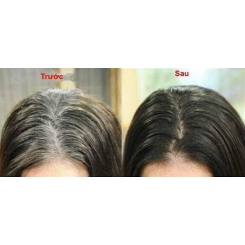 Dầu gội nâu, gội đen tóc Bi Bôp Collagen mẫu mới | BigBuy360 - bigbuy360.vn