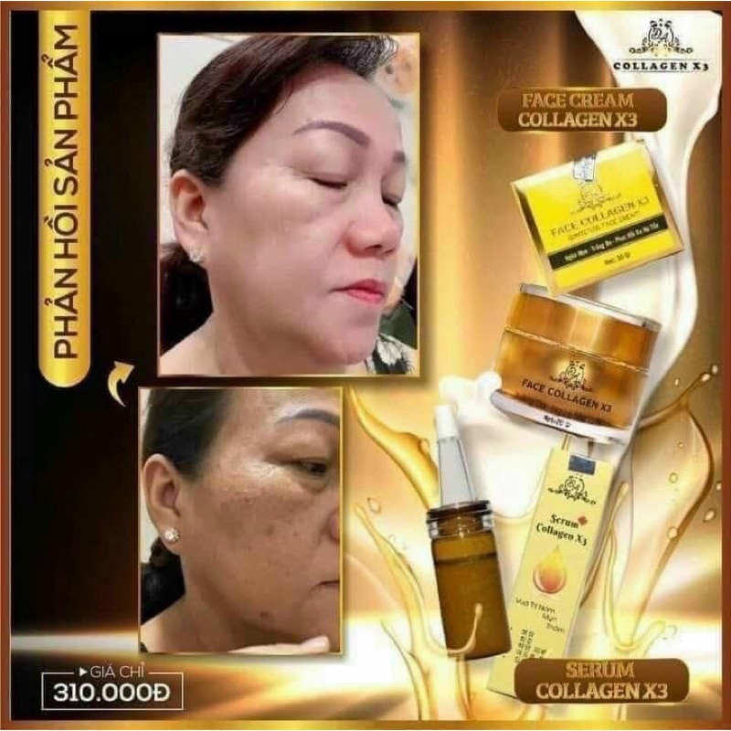 Combo Kem face X3 - Serum nám X3 collagen Đông anh Chính hãng