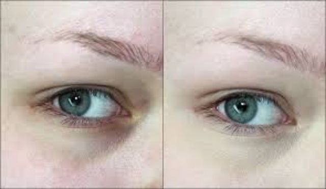 Che Khuyết điểm Make Up For Ever Concealer  Ultra HD | BigBuy360 - bigbuy360.vn