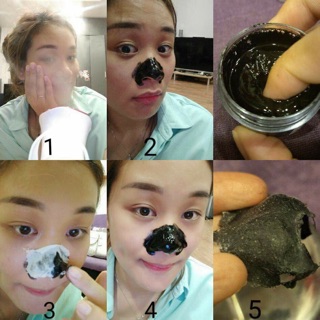 Lột mụn than tre Greenbon