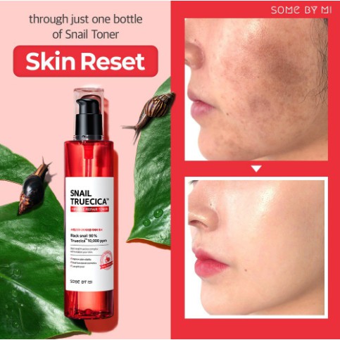 Combo Giúp Da Săn Chắc, Cải Thiện Thâm Sẹo Chiết Xuất Ốc Sên Some By Mi Snail Truecica Miracle Repair (Toner + Serum)