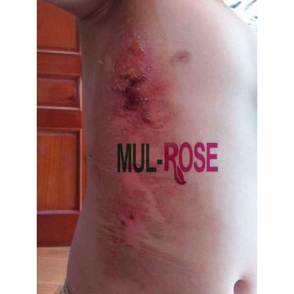 Kem Mul Rose