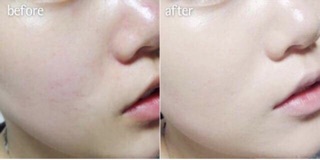 PHẤN NƯỚC WALNUT’S CC BLOOM PERFEEL CUSHION