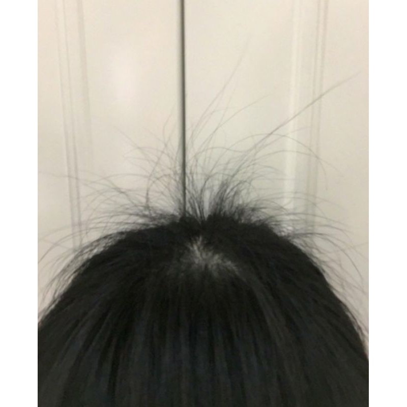 BỘ DẦU GỘI BƯỞI RỪNG (KHẮC TINH RỤNG TÓC) | BigBuy360 - bigbuy360.vn