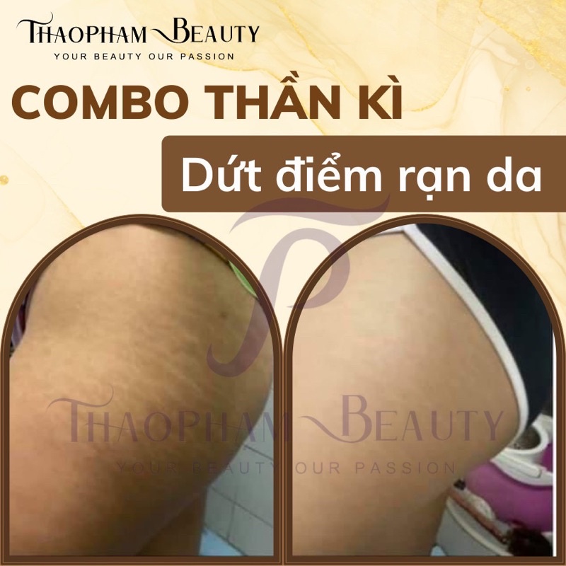 COMBO GIẢM THÂM SẦN RẠN DA BODY CHUYÊN SÂU X1000 KEVA 250gr