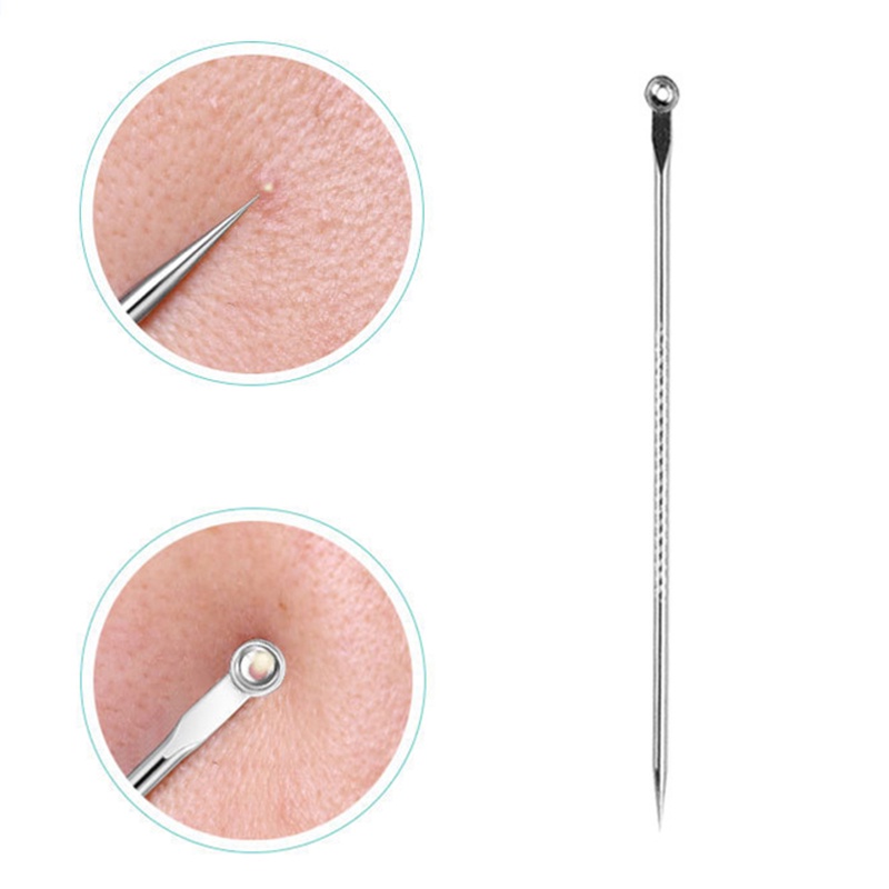 Bộ 4 Dụng Cụ Loại Bỏ Mụn Đầu Đen Làm Sạch Lỗ Chân Lông Chăm Sóc Da Mặt