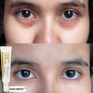 KEM DƯỠNG MẮT SUR.MEDIC 35ML