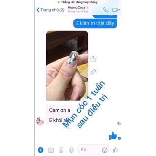 chấm mụn cơm mụn cóc ConCon Thái Lan