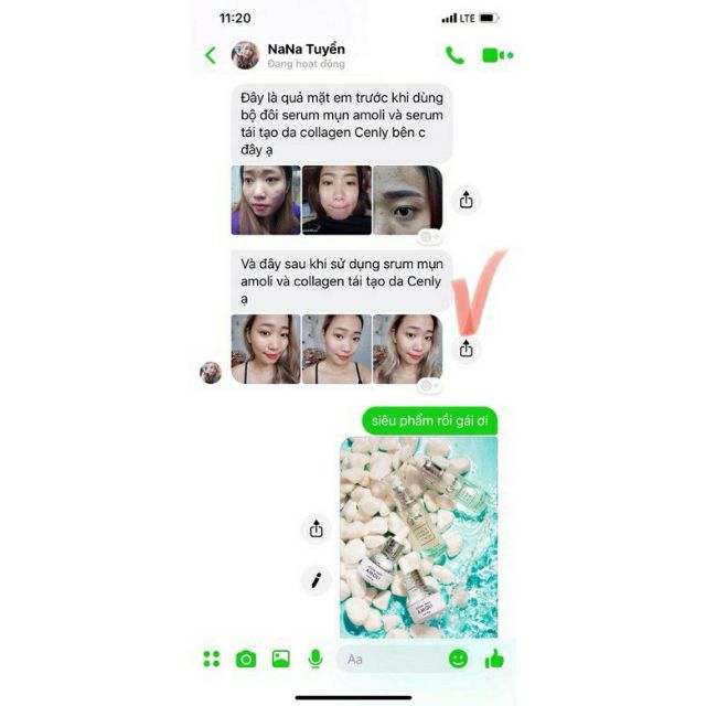 [SIÊU TRỊ MỤN-CHÍNH HÃNG100%] Serum Mụn AMOLI CENLY Đánh Bay Mụn Trong 2-3 Ngày | BigBuy360 - bigbuy360.vn