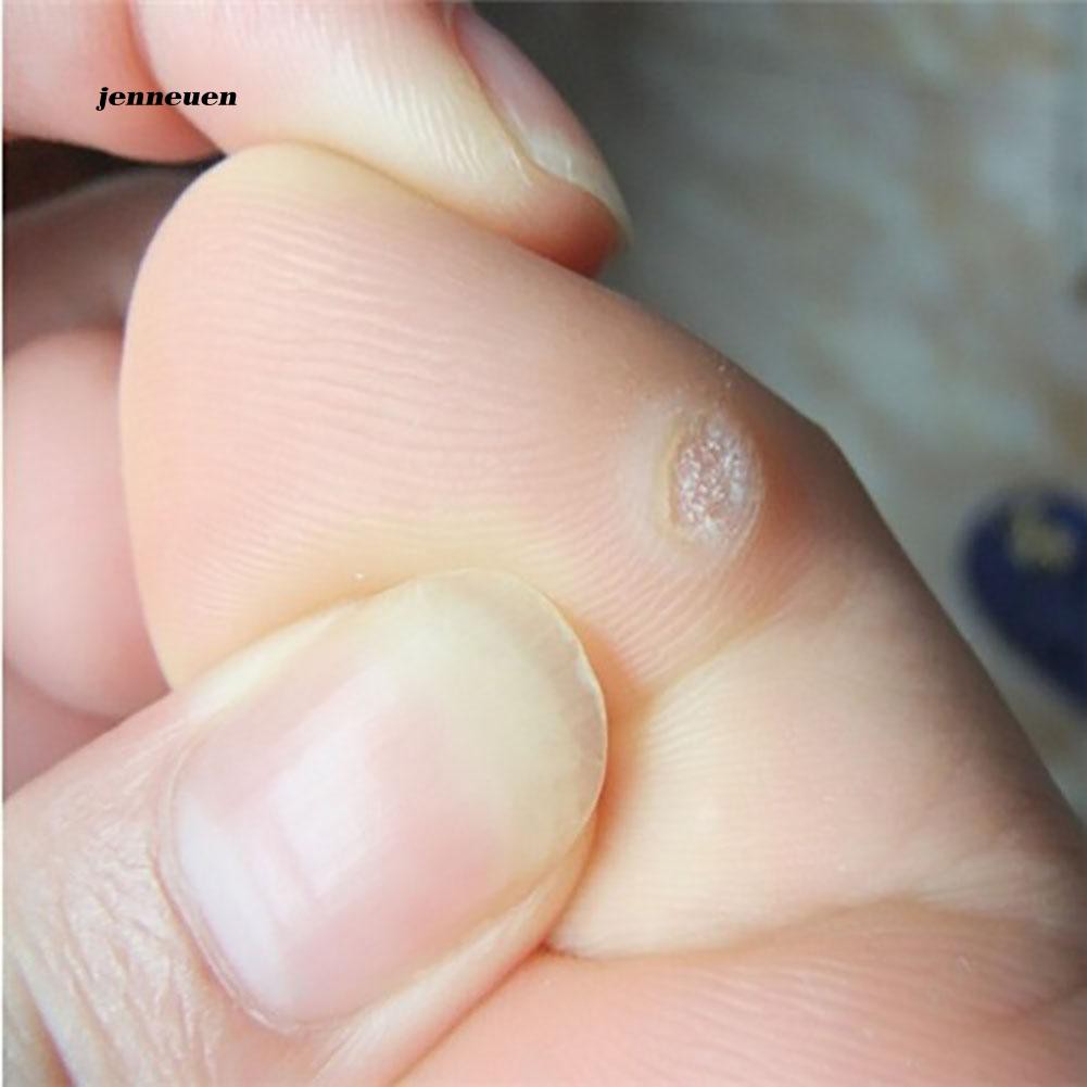 Miếng dán hỗ trợ loại bỏ vết thương hiệu quả tiện dụng