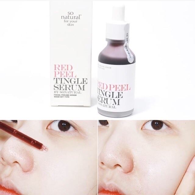 Tinh Chất Tái Tạo Da Red Peel Tingle Serum