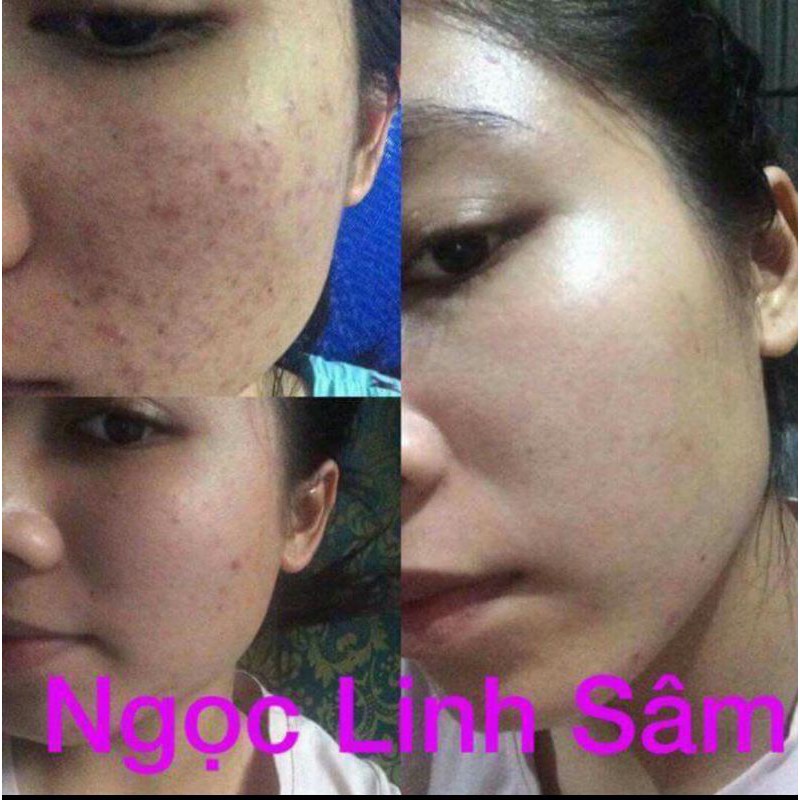 SÊ RUM THẢO DƯỢC TÁI TẠO DA NLS | BigBuy360 - bigbuy360.vn