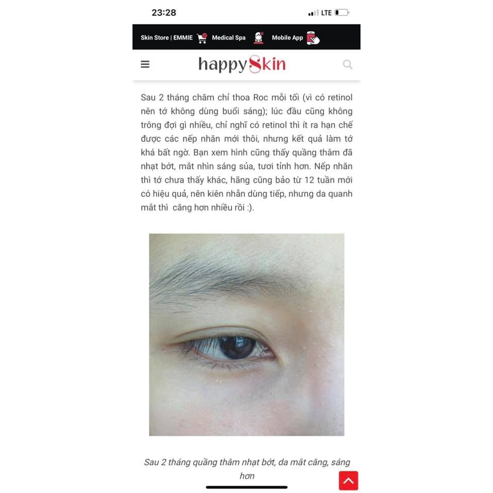 [MẪU MỚI] Kem mắt giúp giảm quầng thâm, giảm nếp nhăn và bọng mắt RoC Retinol Correxion Eye Cream | BigBuy360 - bigbuy360.vn