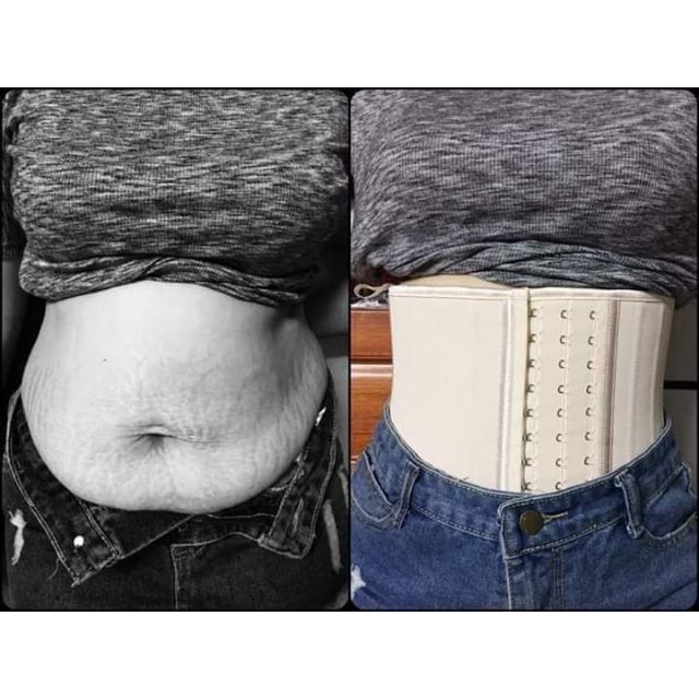 Link sỉ đai gen bụng