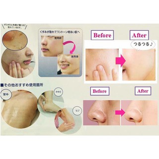 Gel tẩy tế bào chết Texture Peel 150ml