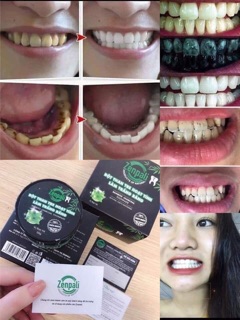 Bột trắng răng than hoạt tính zenpali