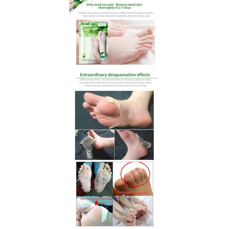 Mặt Nạ Lột Da Chân Peel THAY Da Sinh Học EFERO Làm Trắng Làm Mịn Làm Đều Màu Da Loại Bỏ Da Chết Nội Địa Trung