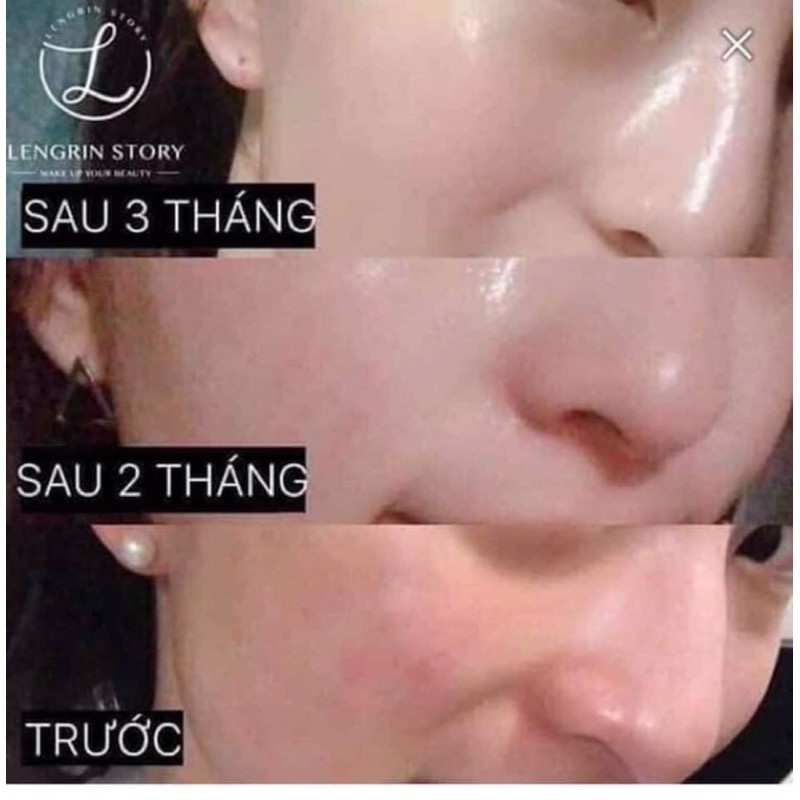 [SẴN]Bột bổ sung collagen samsung pharm Hàn Quốc | BigBuy360 - bigbuy360.vn