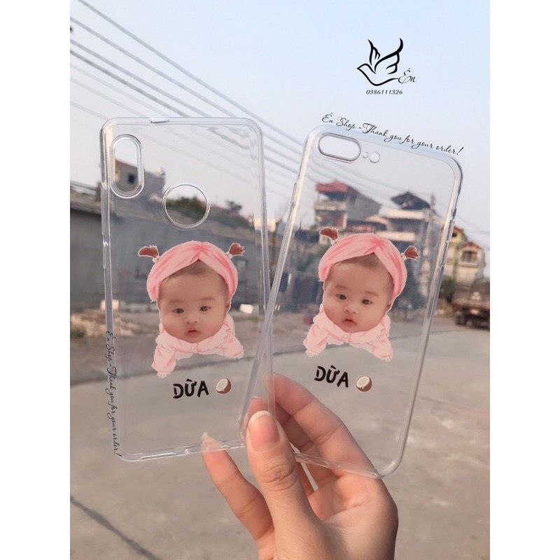 Ốp thiết kế chibi siêu cute cho bé yêu theo yêu cầu nhiều mẫu