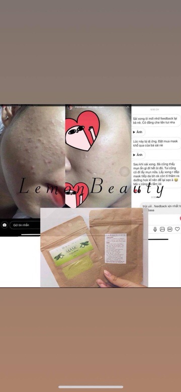 [ MUA 1 MASK TẶNG 1 MASK ] MASK KHỔ QUA RỪNG SALE 84K 🎁 MASK MÔI + CỌ + THÌA PHA | BigBuy360 - bigbuy360.vn