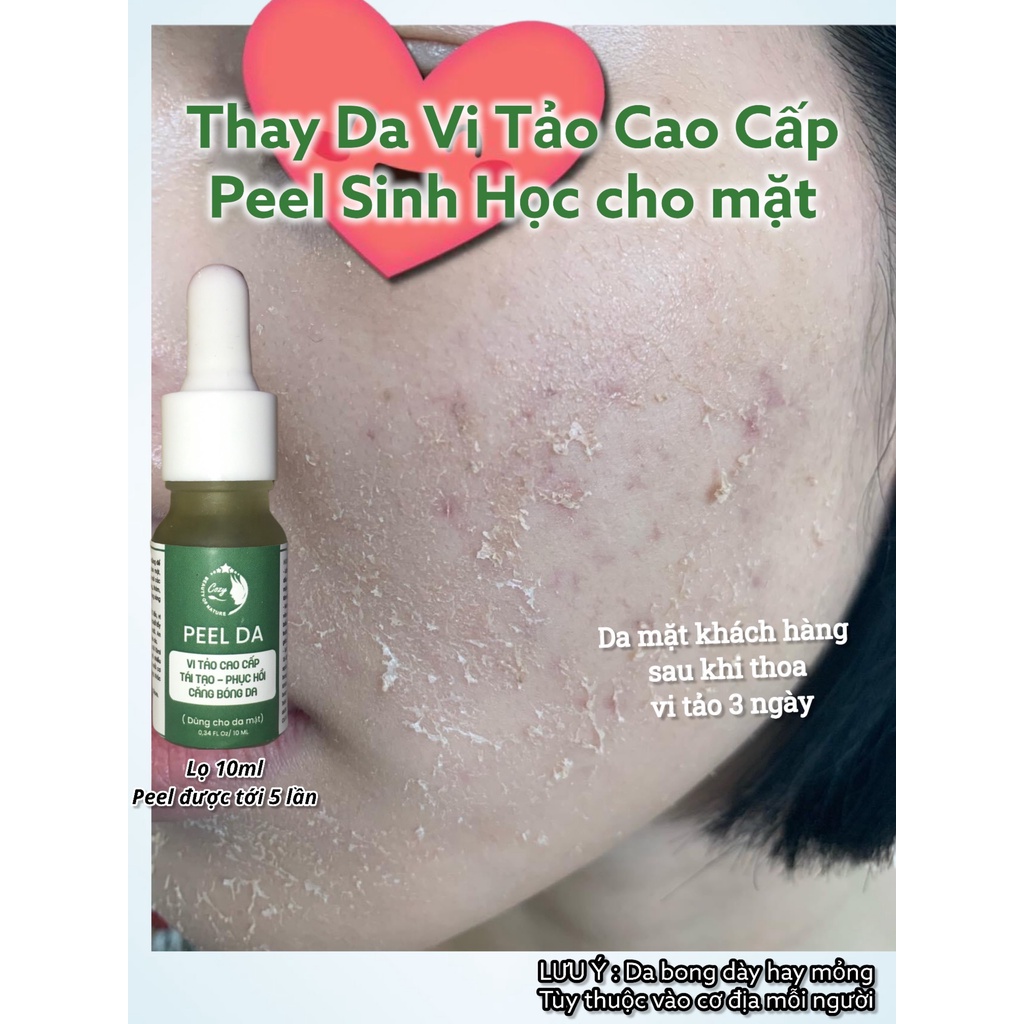 Peel da mặt vi tảo biển COZY - tẩy da chết thay da sinh học cho mặt - Pell lột da mặt - tái tạo da mờ thâm nám