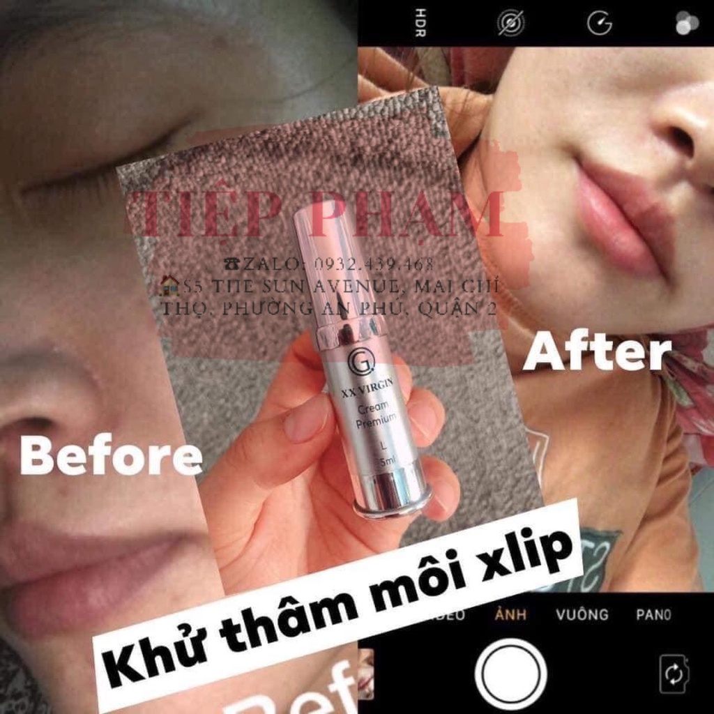 Kem Dưỡng Khử Thâm - Hồng Môi Xxvirgin L 5ml