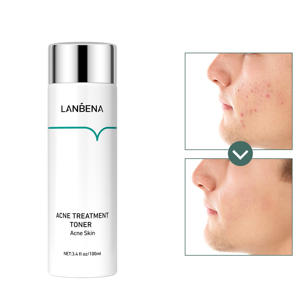 Set 3 Sản Phẩm Lanbena Gồm Toner Peptide Tinh Chất Vàng 24K + Toner Vitamin C + Toner Phục Hồi Dưỡng Ẩm Da