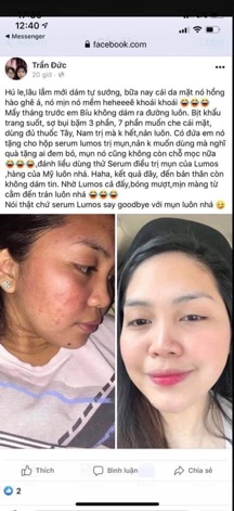 Serum LUMOS ACNE..