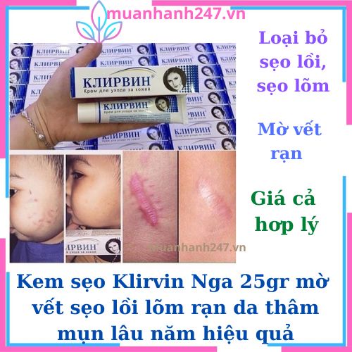 Kem sẹo, kem mờ sẹ Nga mờ vết nhăn vết mổ sẹo lồi lỗm rỗ rạn da lâu năm hiệu quả