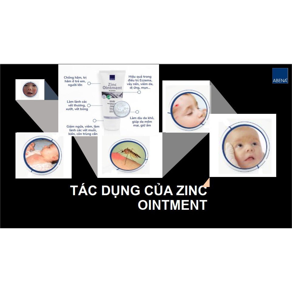 Kem chống hăm đa chức năng Abena Zinc Oinment Nhập Khẩu Đan Mạch