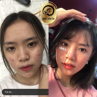 [Loại Mạnh] Tinh Chất Hoàng Thiên Sâm