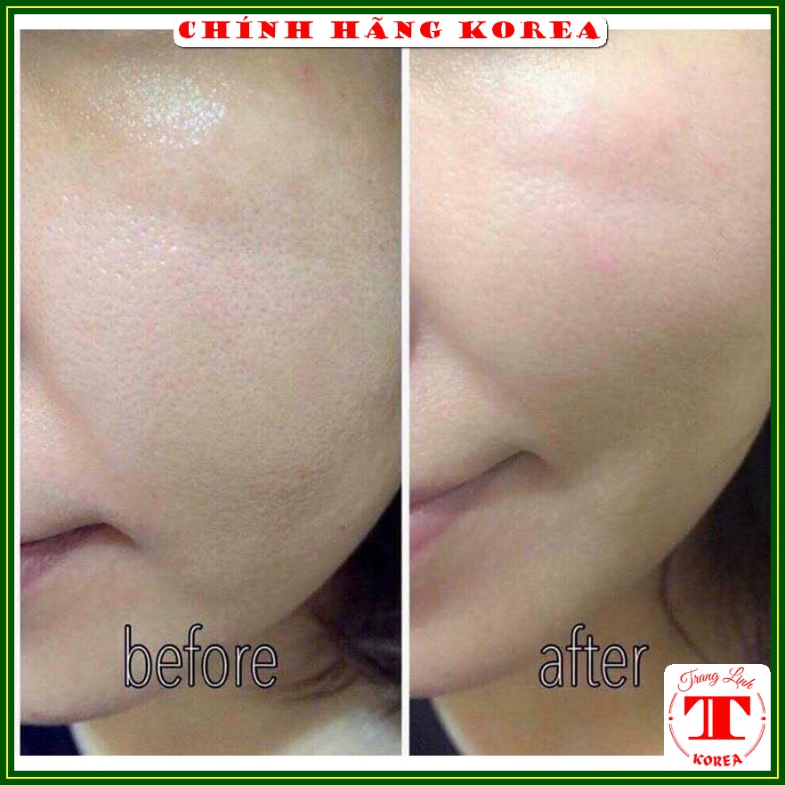 Viên cấp nước Aqua Rich hàn quốc, hộp 70 viên - Bổ sung collagen và nước, giúp da căng bóng, mịn màng - tranglinh