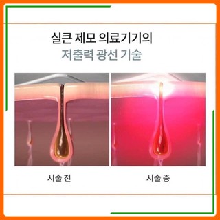 Máy triệt lông Kakkuda Nội Địa Hàn Quốc
