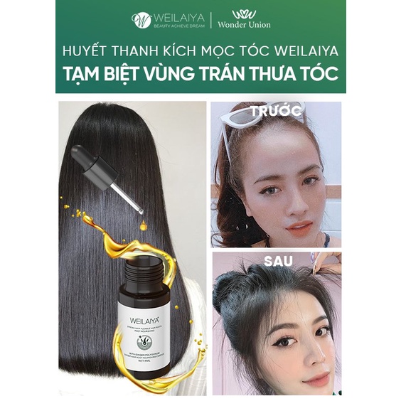 Tinh dầu dưỡng tóc Weilaiya Ginger Hair Root Nourishing Essence giúp ngăn rụng và kích thích mọc tóc 5ml x 8 lọ