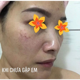 Bộ sản phẩm Gzonnio