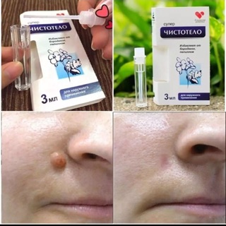 Gel Dvelinil Thuốc Tẩy Nốt Ruồi An Toàn Hiệu Quả
