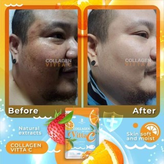 VIÊN UỐNG COLLAGEN VITTA C