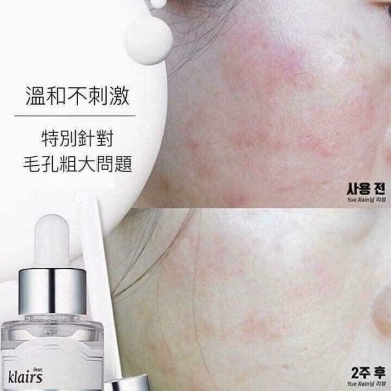 Serum Tinh Chất Klairs Vitamin C sáng da mờ thâm