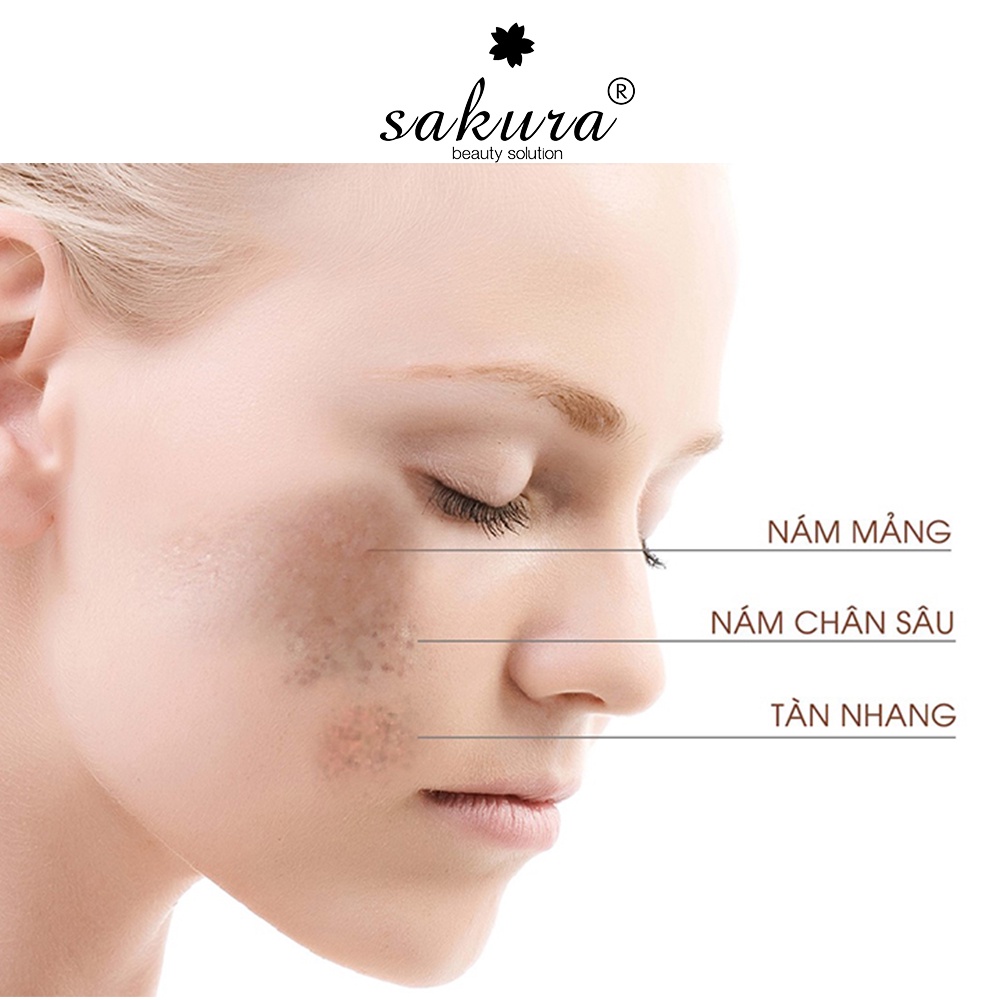 Viên ngừa nám chuyên sâu Sakura HCL White Blossom EX 120 viên