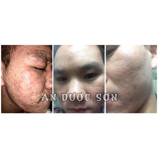 Serum An Dược Sơn - Chai 50ml (Tặng vòng tay gỗ huyết long)