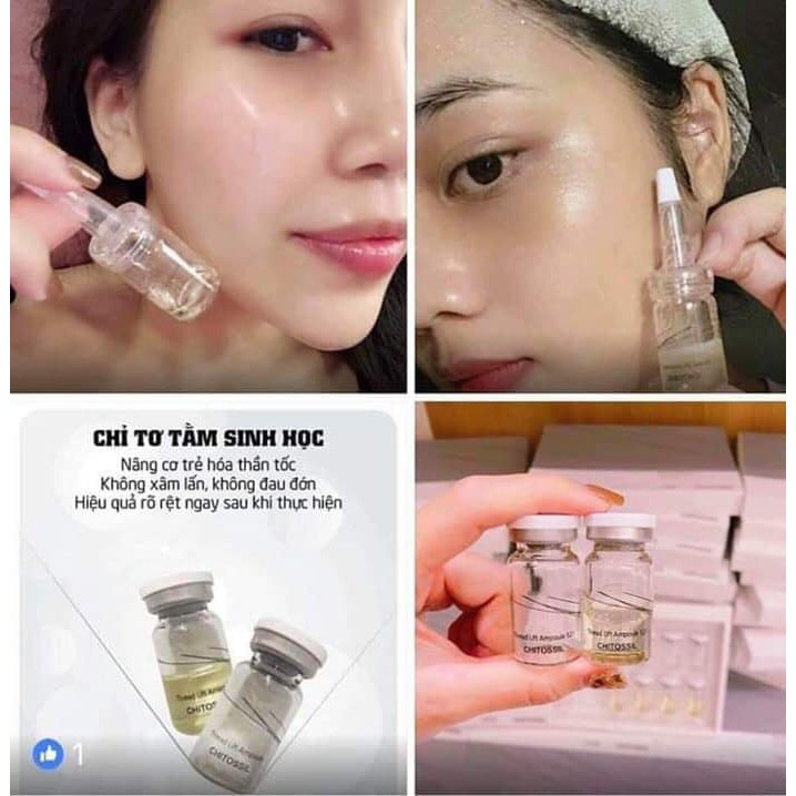 Chỉ tơ tằm cấy chỉ hàn quốc dùng trong spa thẫm mỹ viện