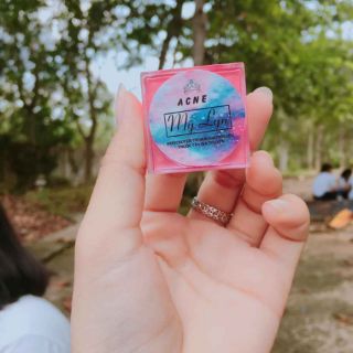 ACNES MỸ LYN