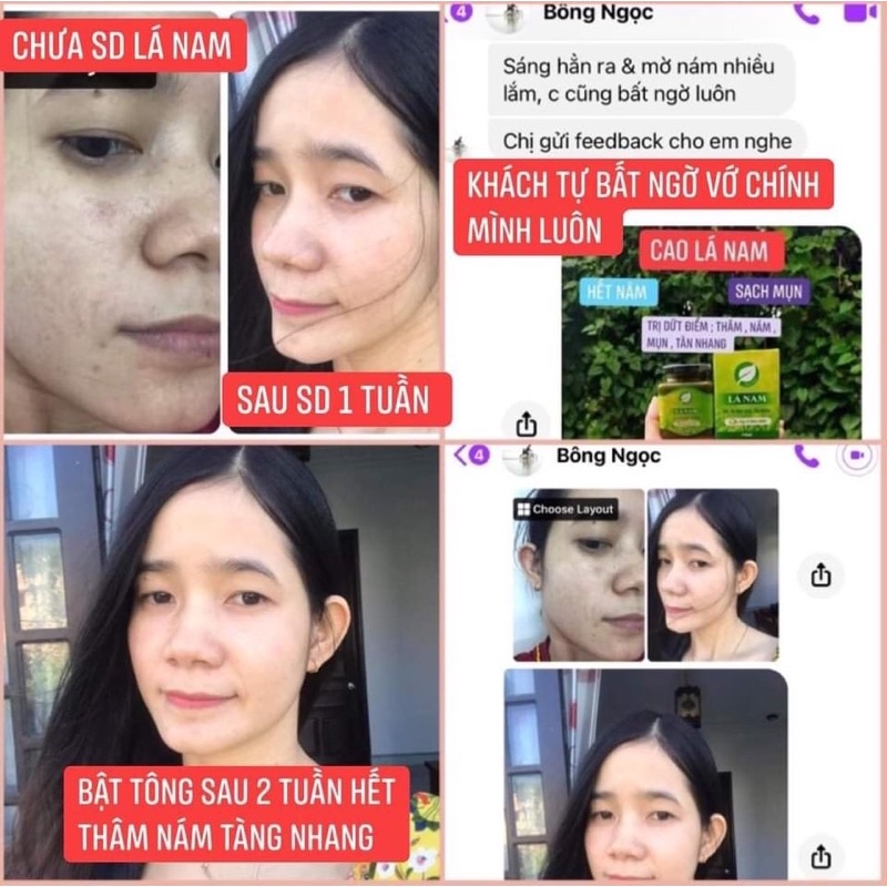 Cao Lá Nam - Xóa bỏ Nám, Tàn nhan và Thâm mụn sau 7 ngày sử dụng