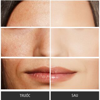 Serum Sakura New Age Perfect Concentrate q10