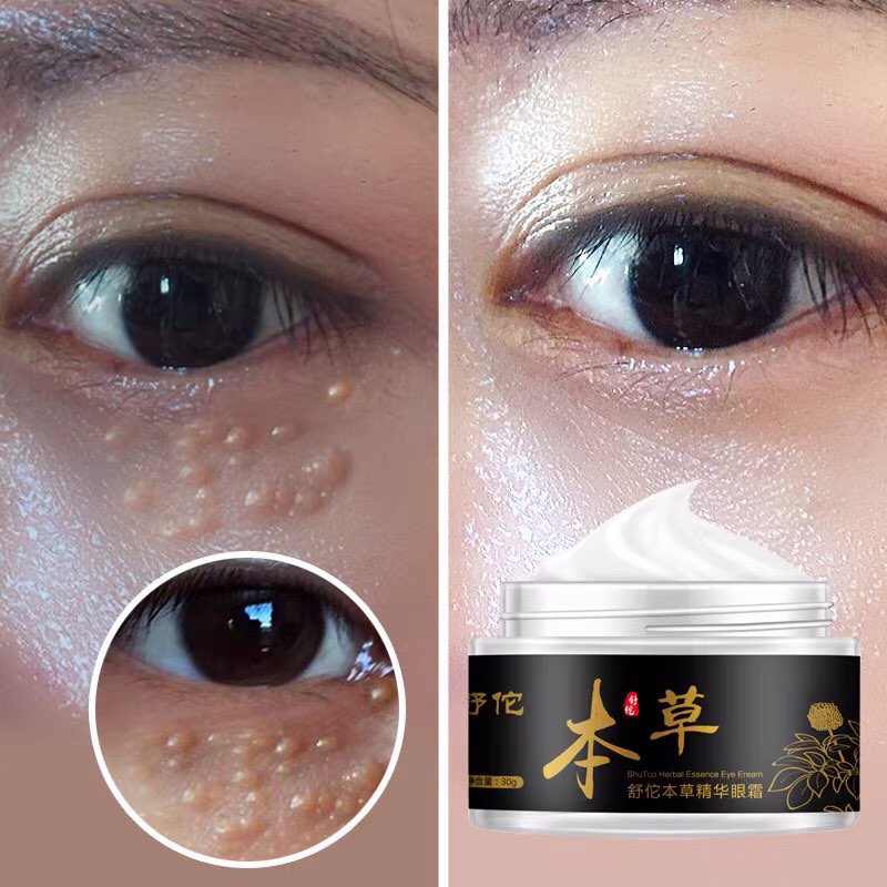 Kem bôi mụn cóc - mụn thịt - thâm quầng mắt - dưỡng ẩm cho mắt (Cực hiệu quả) | BigBuy360 - bigbuy360.vn