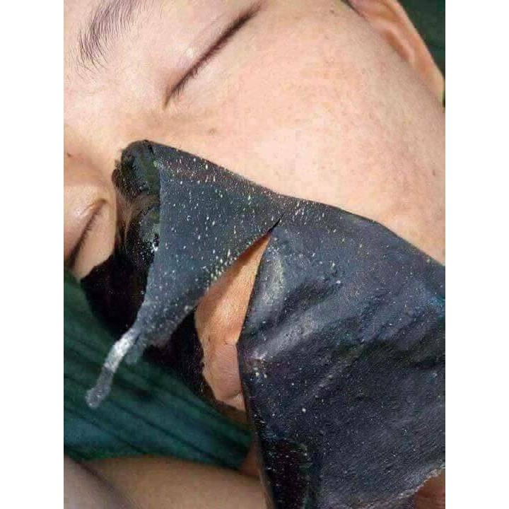 [Chính Hãng] GEL LỘT MỤN THAN TRE NGÂN BÌNH - Siêu Sạch Lột Sạch Mụn Cám, Mụn Đầu Đen, Se Lỗ Chân Lông | BigBuy360 - bigbuy360.vn